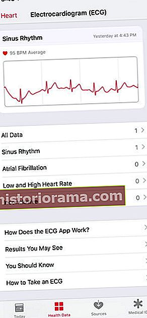 jak používat aplikaci ECG nastavit upozornění na nepravidelný rytmus údaje o Apple Watch Health