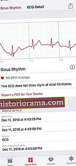 Ako používať aplikáciu EKG Nastaviť upozornenia na nepravidelný rytmus Apple Watch 3